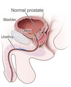 Prostate gland anatomy graphic, sagittal section.