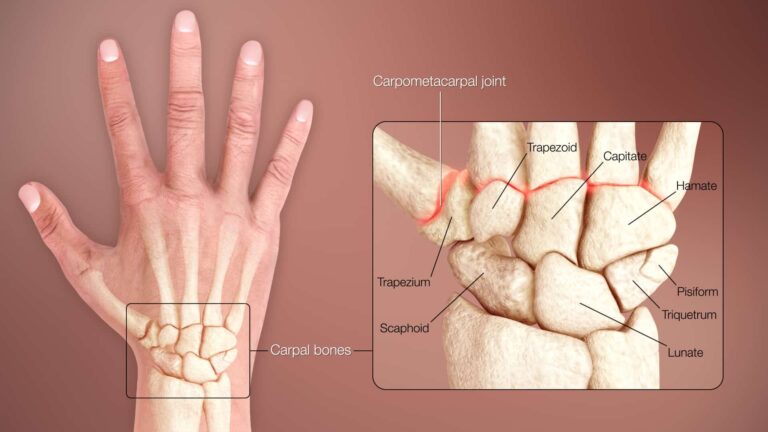 Image sowing wrist anatomy